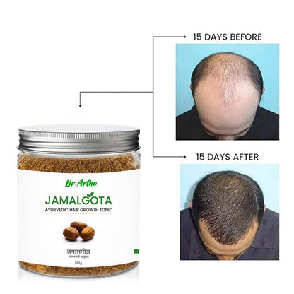Jamalgota Powder for Hair Growth, Natural Skin & Hair Solution ( Pack Of 2 )