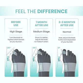 Toe Straightener Bunion Corrector for Women and Men