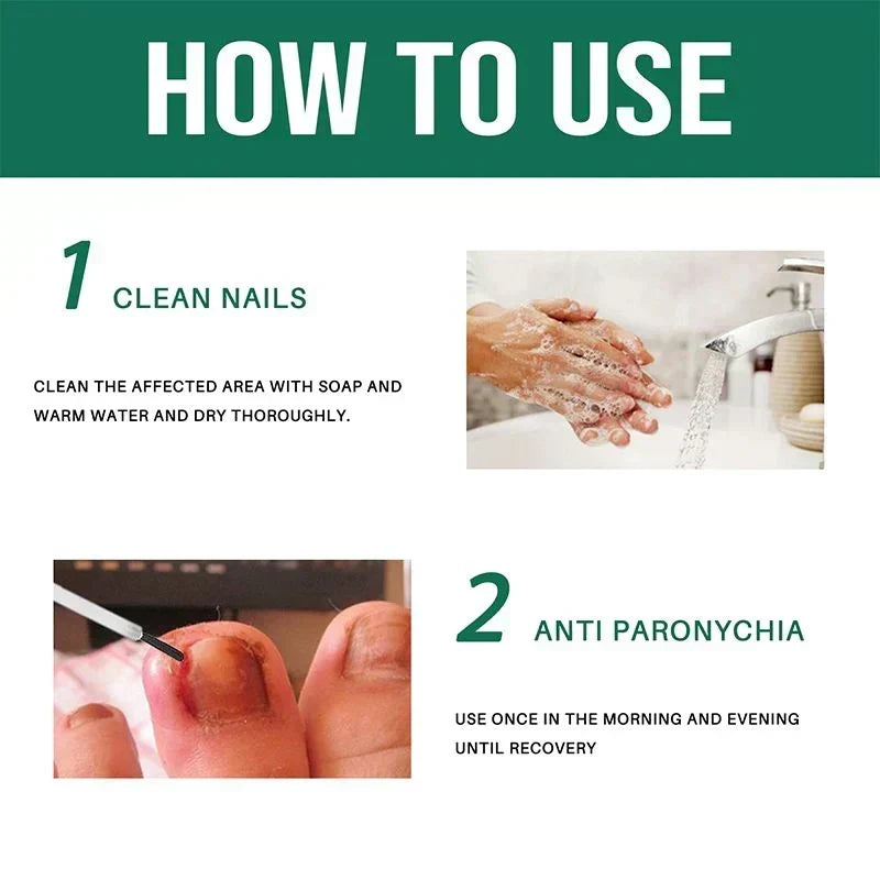 Anti Paronychia Relief Oil (Pack of 2)